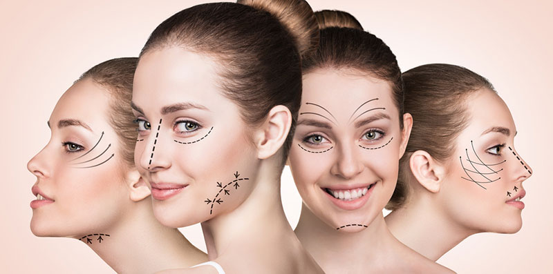 Face lift surgery